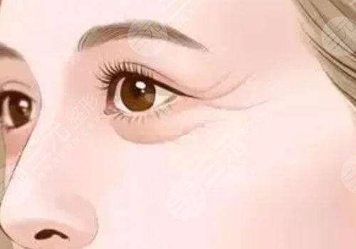 薇旖美可以注射眼部周圍的皺紋不？