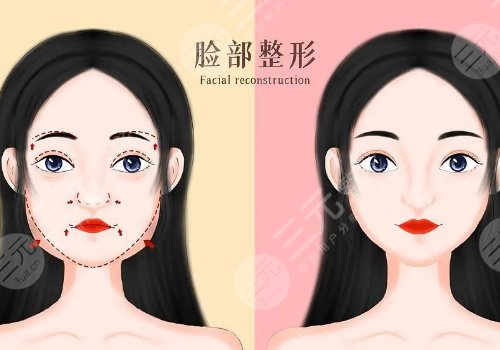 全臉幼態(tài)臉打造大概需要多少費(fèi)用？