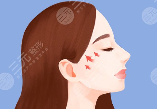 輪廓固定提升多少錢？