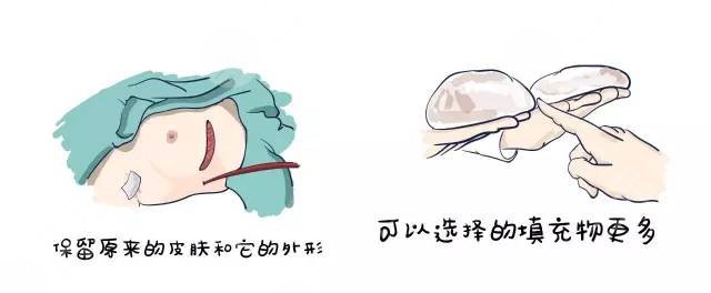 上海長(zhǎng)海醫(yī)院整形科朱吉醫(yī)生擅長(zhǎng)項(xiàng)目科普