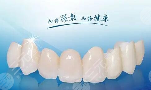 烤瓷牙多少錢一顆價(jià)格表2023查詢！牙齒修復(fù)必備~