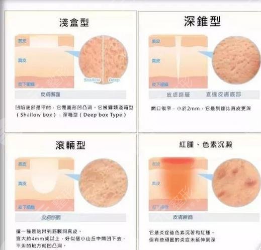 上海華山醫(yī)院點陣激光醫(yī)生介紹