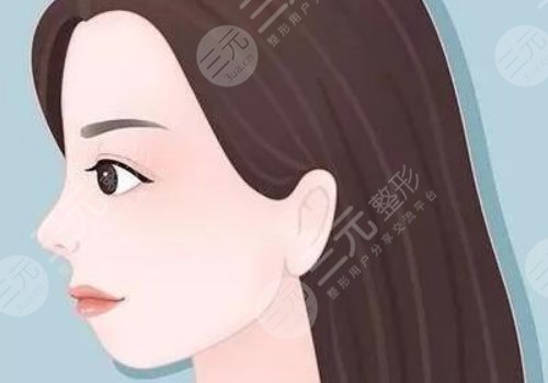 下巴后縮可以矯正過來嗎？