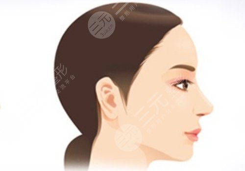 下巴后縮可以矯正過來嗎？