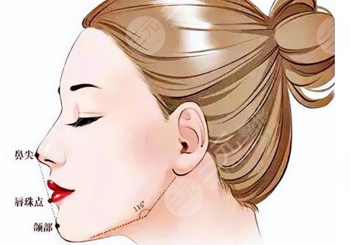 下巴后縮可以矯正過來嗎？