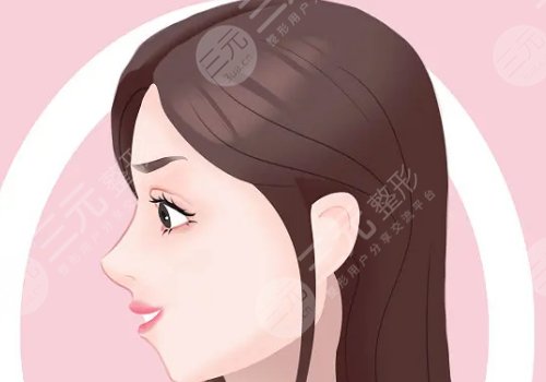 下巴后縮是什么原因造成的