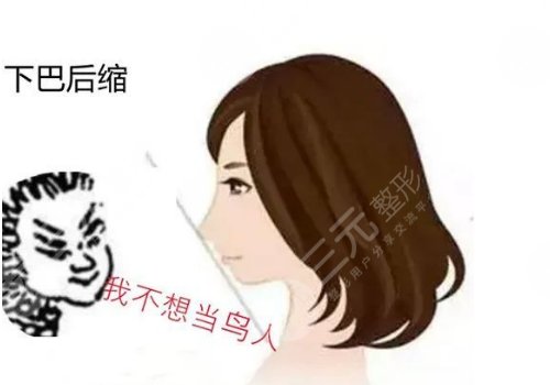 下巴后縮是什么原因造成的