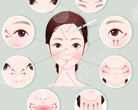 面部整形