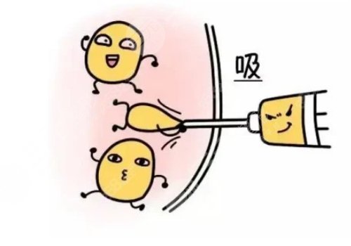 腰腹部抽脂對身體有什么傷害?