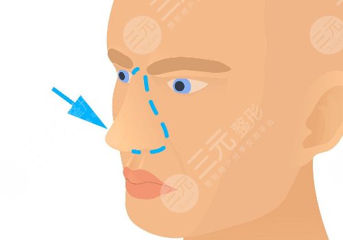 浙江省中醫(yī)院整形科好不好？