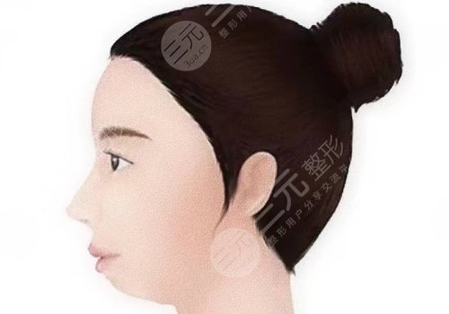 下巴后縮嘴凸怎么改良