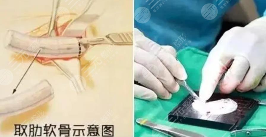 上海仁濟醫(yī)院整形美容外科擅長項目科普