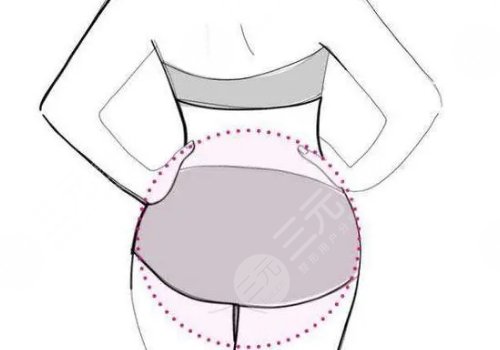 人魚體雕可以維持多久？