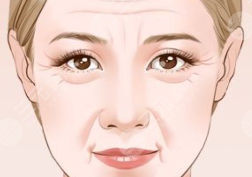 思伊美玻尿酸多少錢一支