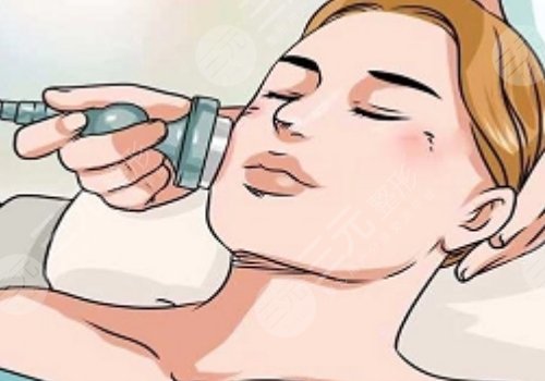 光子嫩膚m22多少錢啊