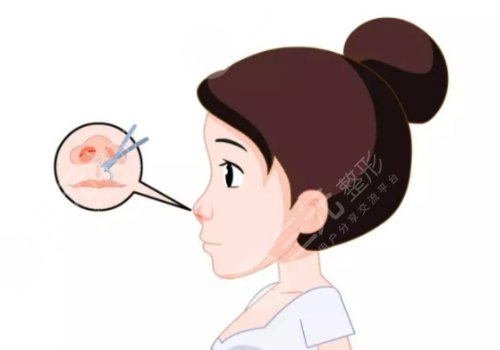 杭州藝星鼻修復醫(yī)生