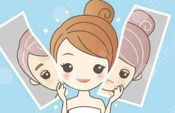 北部戰(zhàn)區(qū)總醫(yī)院光子嫩膚案例