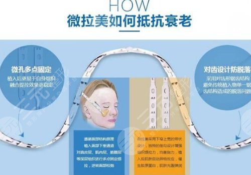 微拉美多少錢一次