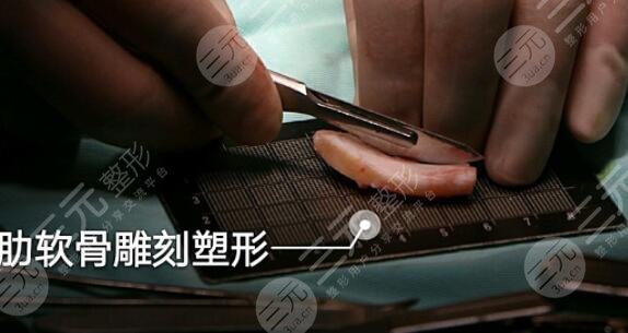 綜合鼻和肋骨鼻各自的優(yōu)勢(shì)有哪些?