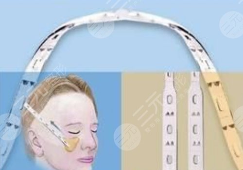 微拉美的危害和副作用