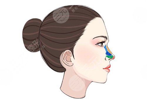 做鼻子二十多萬是不是被坑了