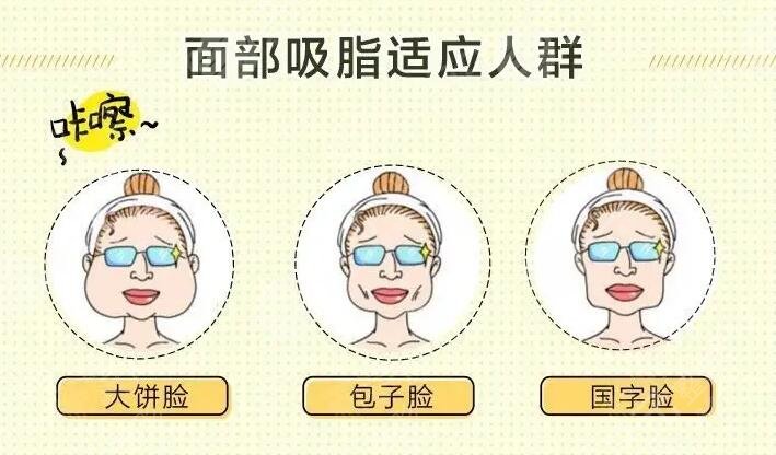 曾海峰面部吸脂科普: