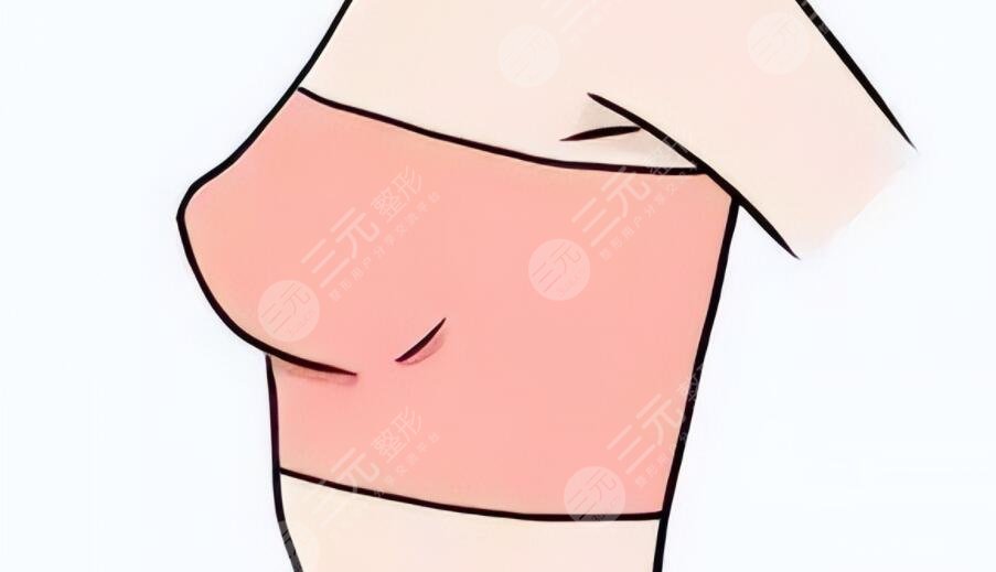 做了假體隆胸會不會癌變?乳腺專家跟蹤調(diào)查后總結~