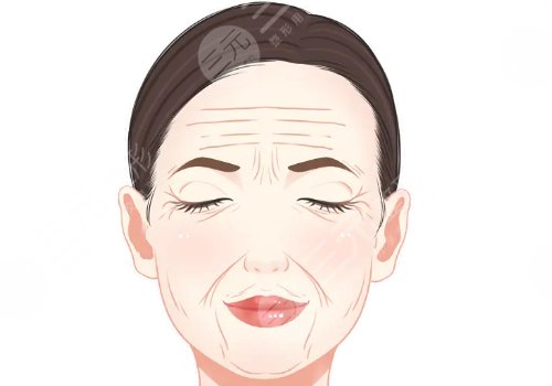 筋膜提升術(shù)多少錢？