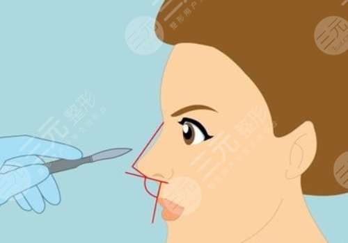 水滴鼻和鷹鉤鼻圖片