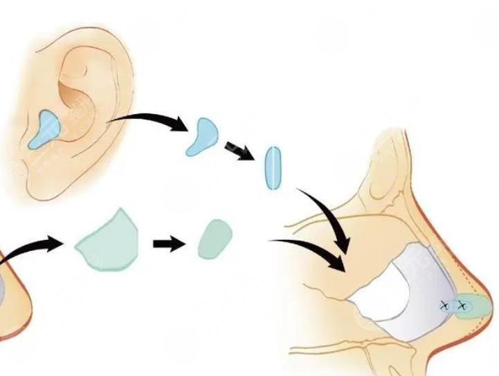杭州美萊科室擅長項(xiàng)目科普
