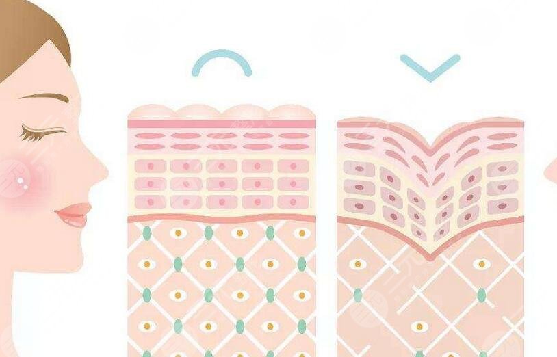 40歲抗衰老醫(yī)美項目有哪些？