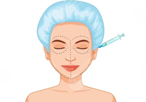 艾維嵐注射后多久消腫？