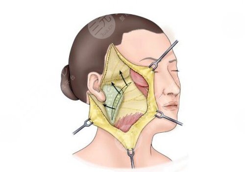 北京豐聯(lián)麗格