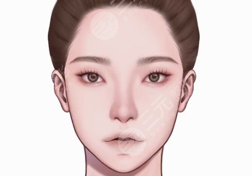 北京王冀耕做雙燕尾拉皮能維持幾年？