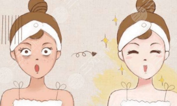 上海同濟醫(yī)院光子嫩膚案例