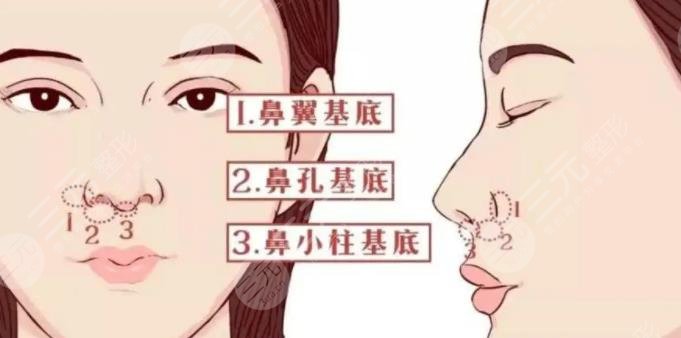 鼻基底
