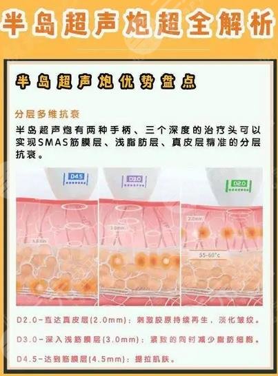 半島黃金超聲炮和超聲炮的區(qū)別有哪些？