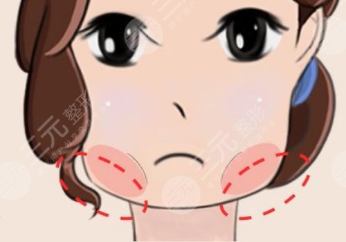 削骨三年后的真實案例