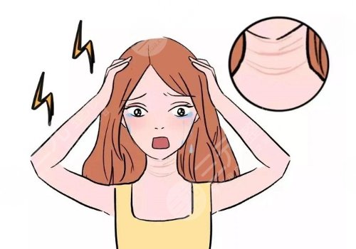 頸部皮膚松弛有什么辦法可以改良？