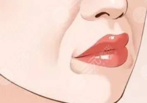 口周年輕化整形美容的常用方法有哪些？