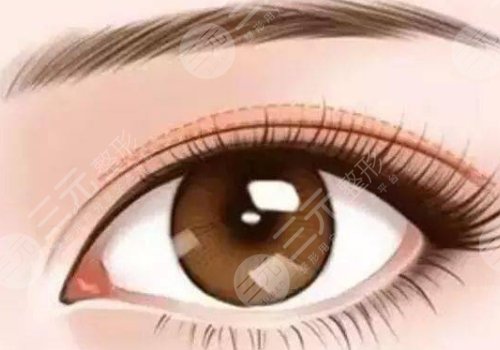 南醫(yī)三院雙眼皮掛什么科