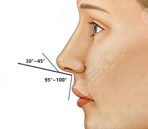 自體脂肪隆鼻手術(shù)