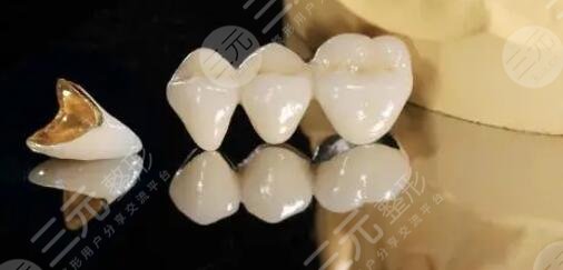 曲靖第一人民醫(yī)院口腔醫(yī)院