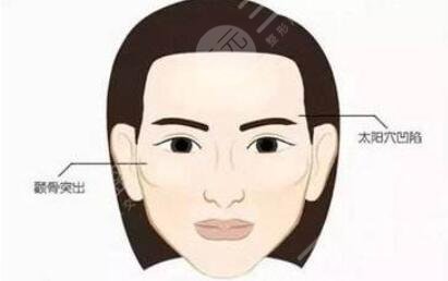 豐太陽穴