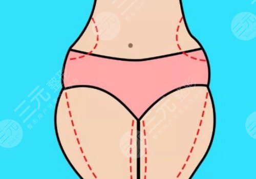 臀部脂肪怎么減？