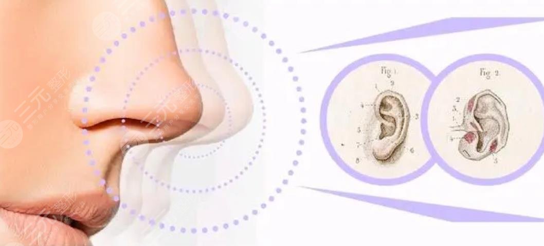 王榮錫醫(yī)生隆鼻案例