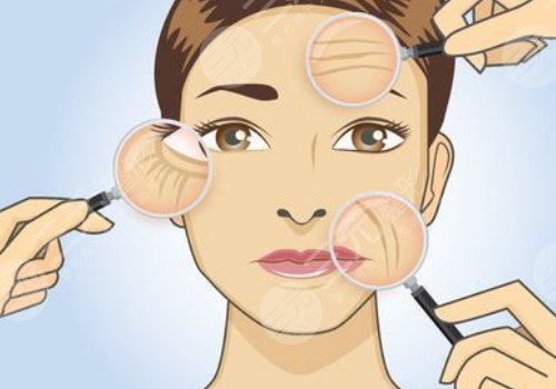 小切口拉皮手術(shù)可以維持多久