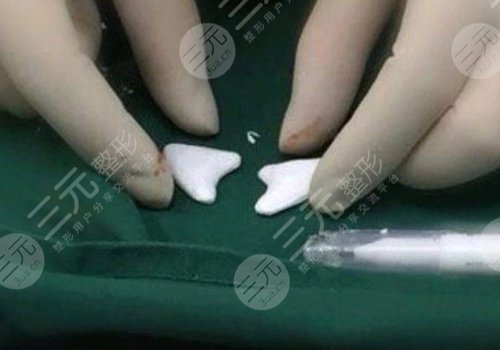 猴化臉鼻基底怎么解決