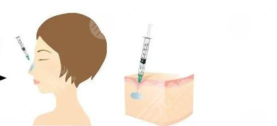 杭州美萊做鼻子誰做的好?