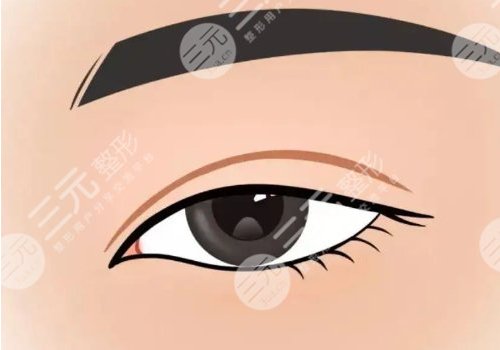 樸一飛美杜莎雙眼皮